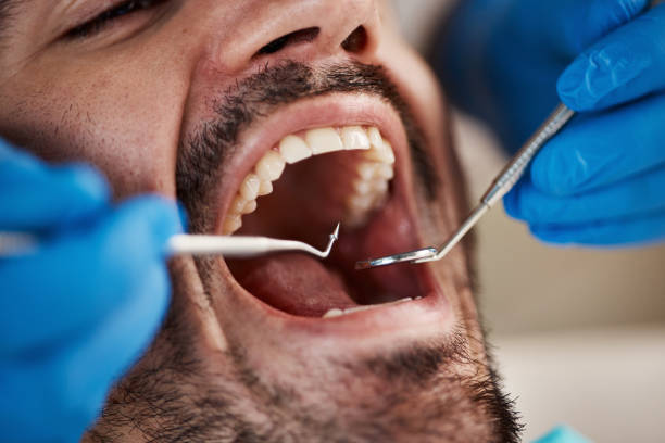 Best Walk-In Emergency Dentist in Liberty, PA